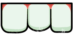 Huge Teeth